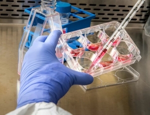 OMS: hay 780 casos de viruela del mono en países no endémicos, pero el nivel de riesgo global es moderado